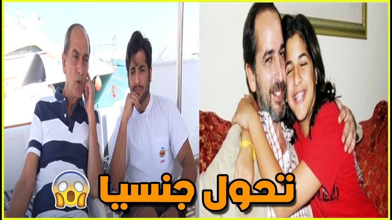 صور نورا ابنة هشام سليم قبل وبعد العملية