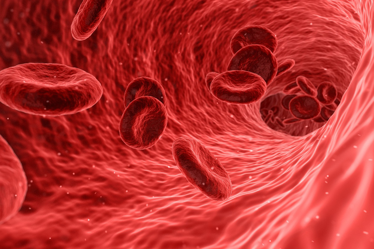 نقص الصفائح الدموية عند الأطفال الأسباب والأعراض والعلاج