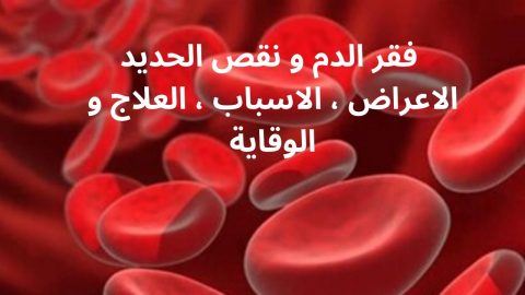 فقر الدم الحاد كم نسبته ومتى يكون خطر ؟