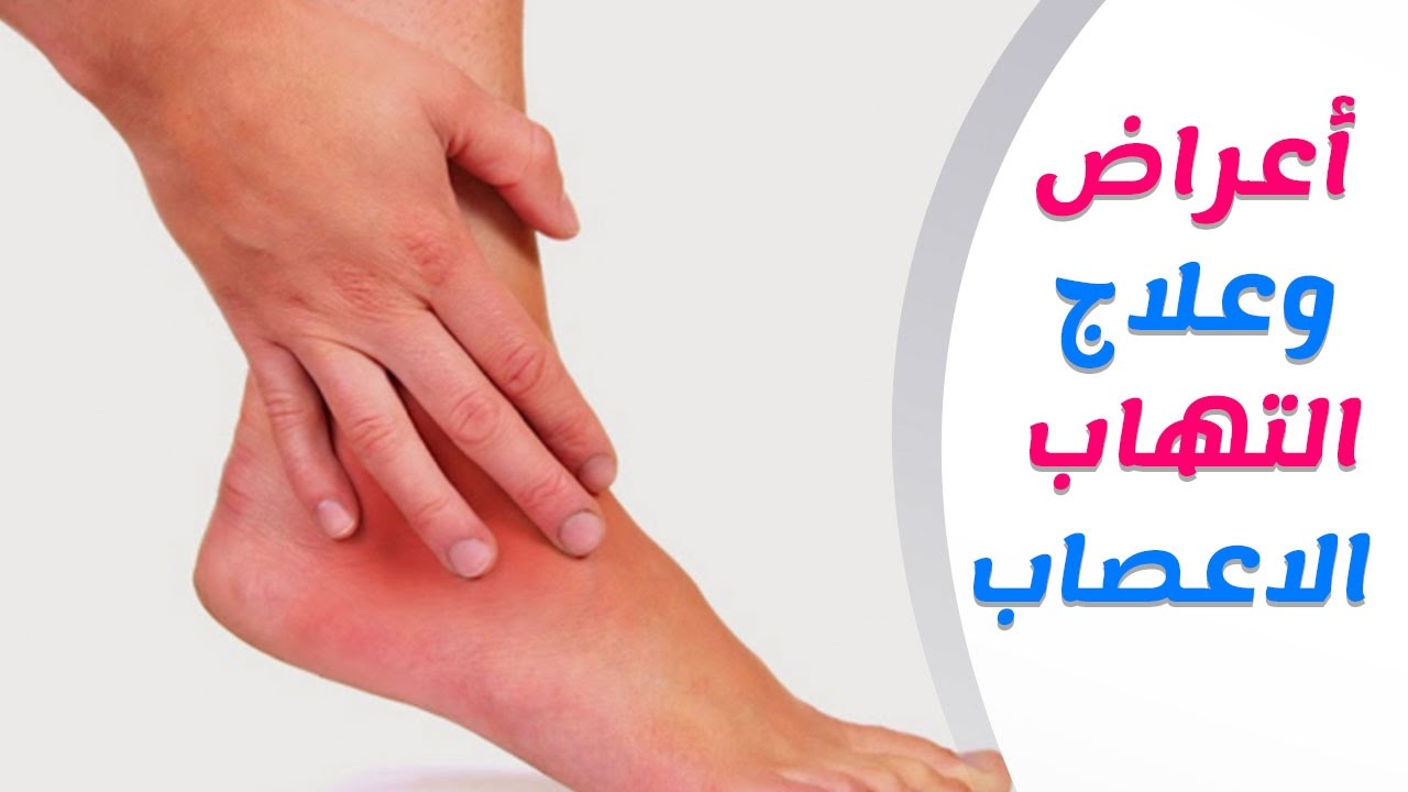 كيفية علاج التهاب أعصاب الساقين وأعراضه وتشخيصه