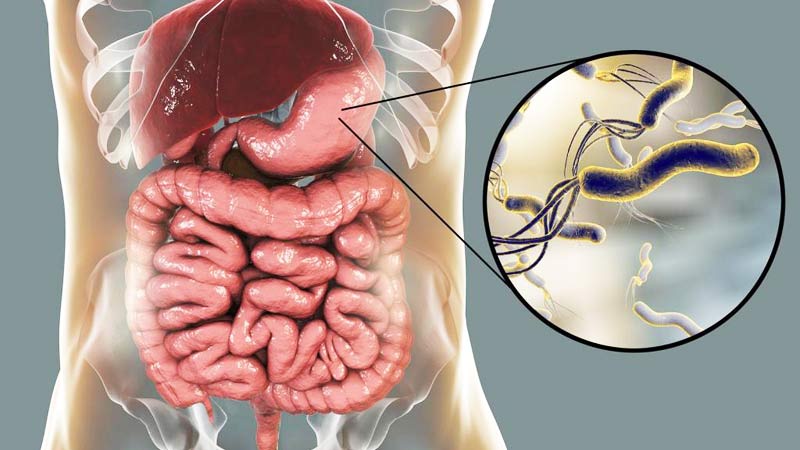 علاج بكتيريا المعدة علاج بكتيريا المعدة
