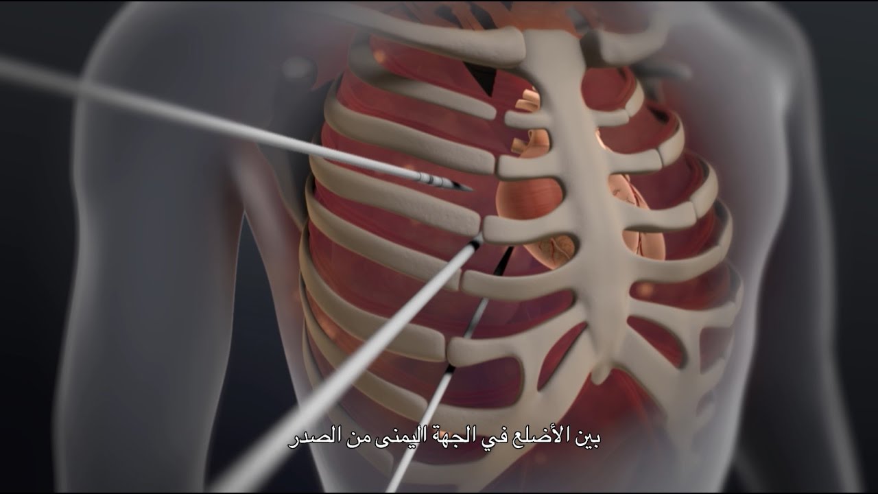 الصمامات توجد في
