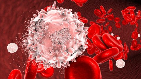 خطوات علاج سرطان الدم أحدث علاجات “اللوكيميا”2021