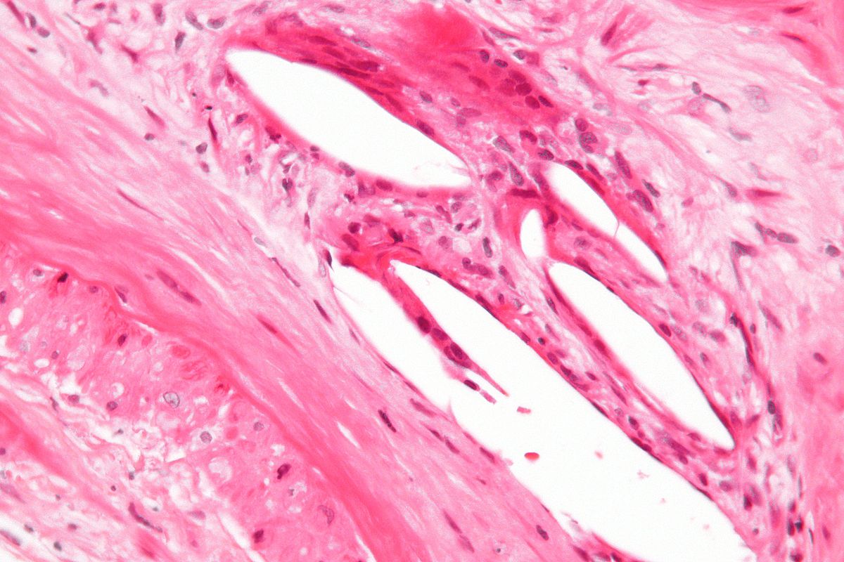 ما أنشطة الجسم الأخرى التي تتحكم فيها العضلات الاإرادية