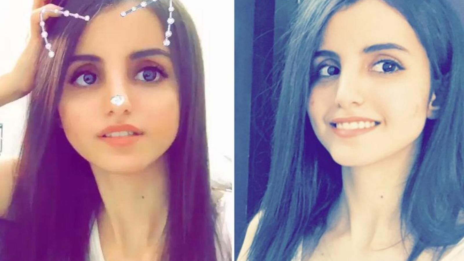 اطلاق النار على فوز العتيبي ماذا حدث ؟ تفاصيل وحقيقة الحادث