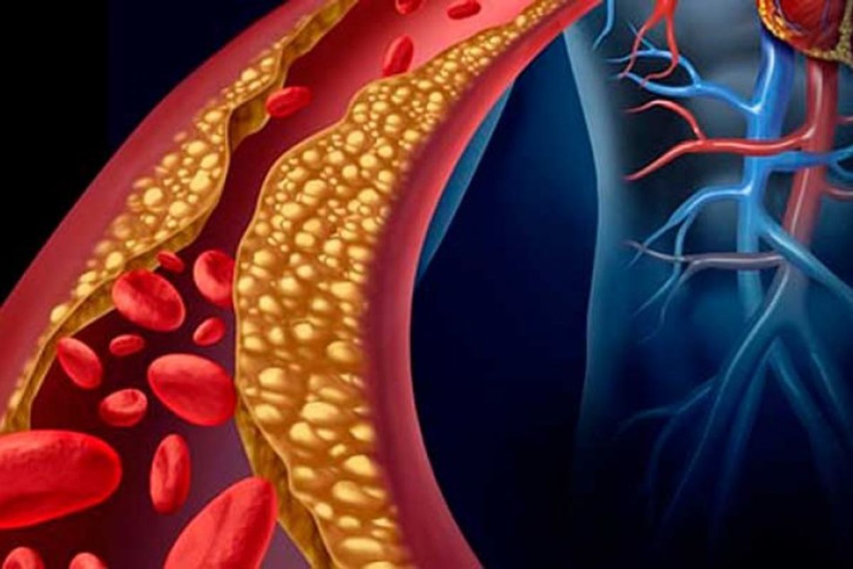 ما هو اكبر شريان في جسم الانسان