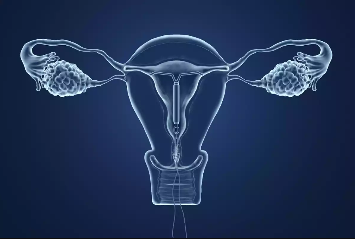 الكيس الدهني في الرحم اسبابه واعراضه وعلاجه