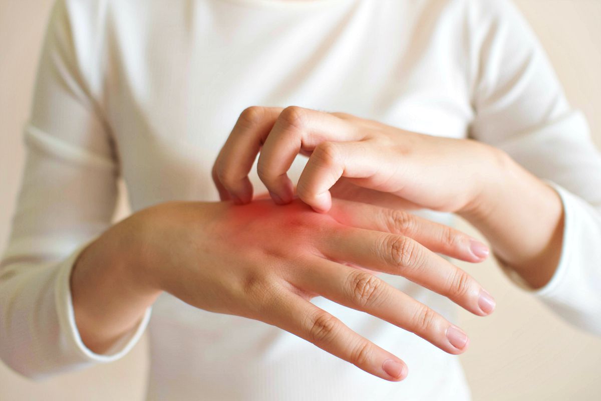 أسماء أدوية الحساسية الجلدية 2024