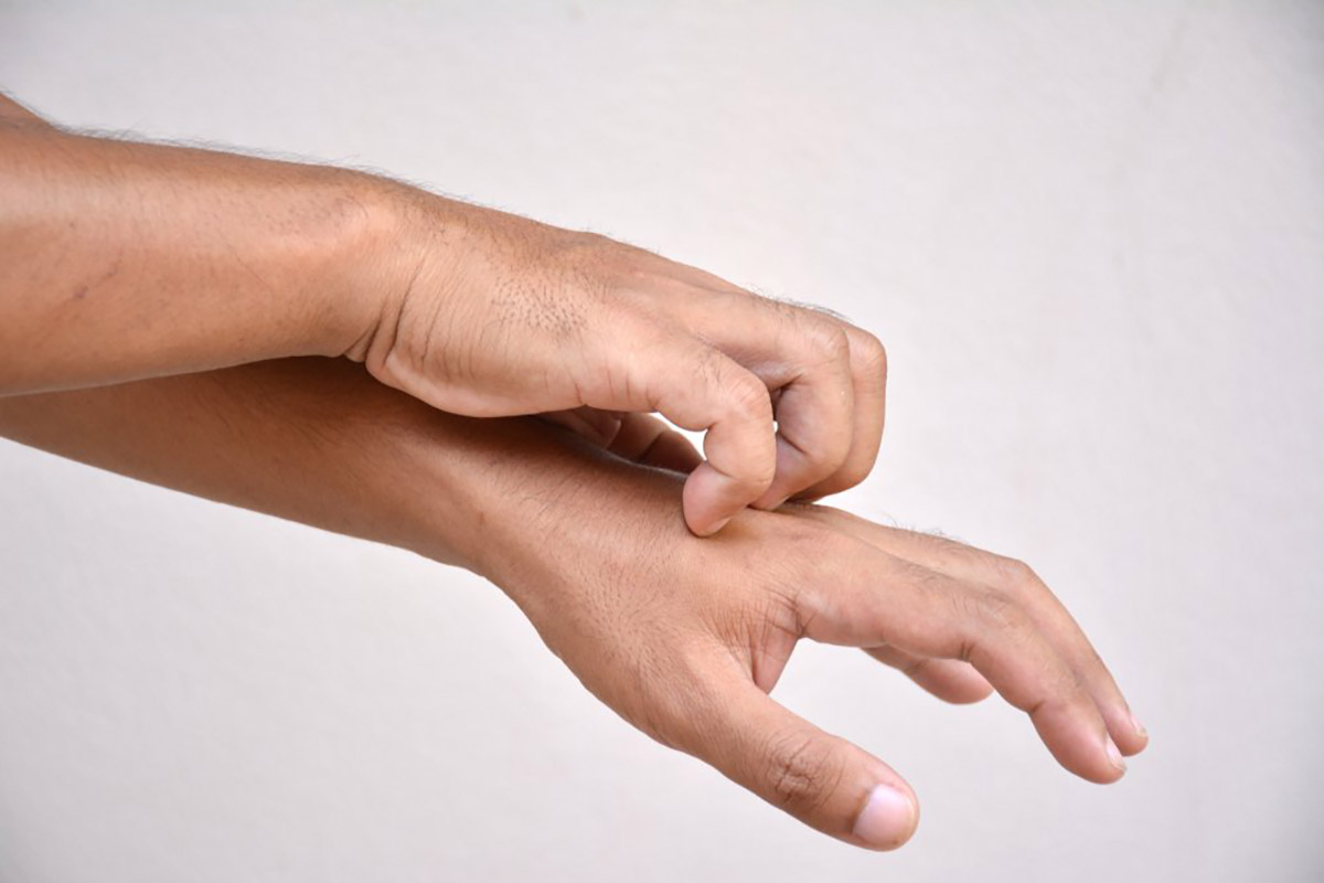 متى تكون الحكة خطيرة