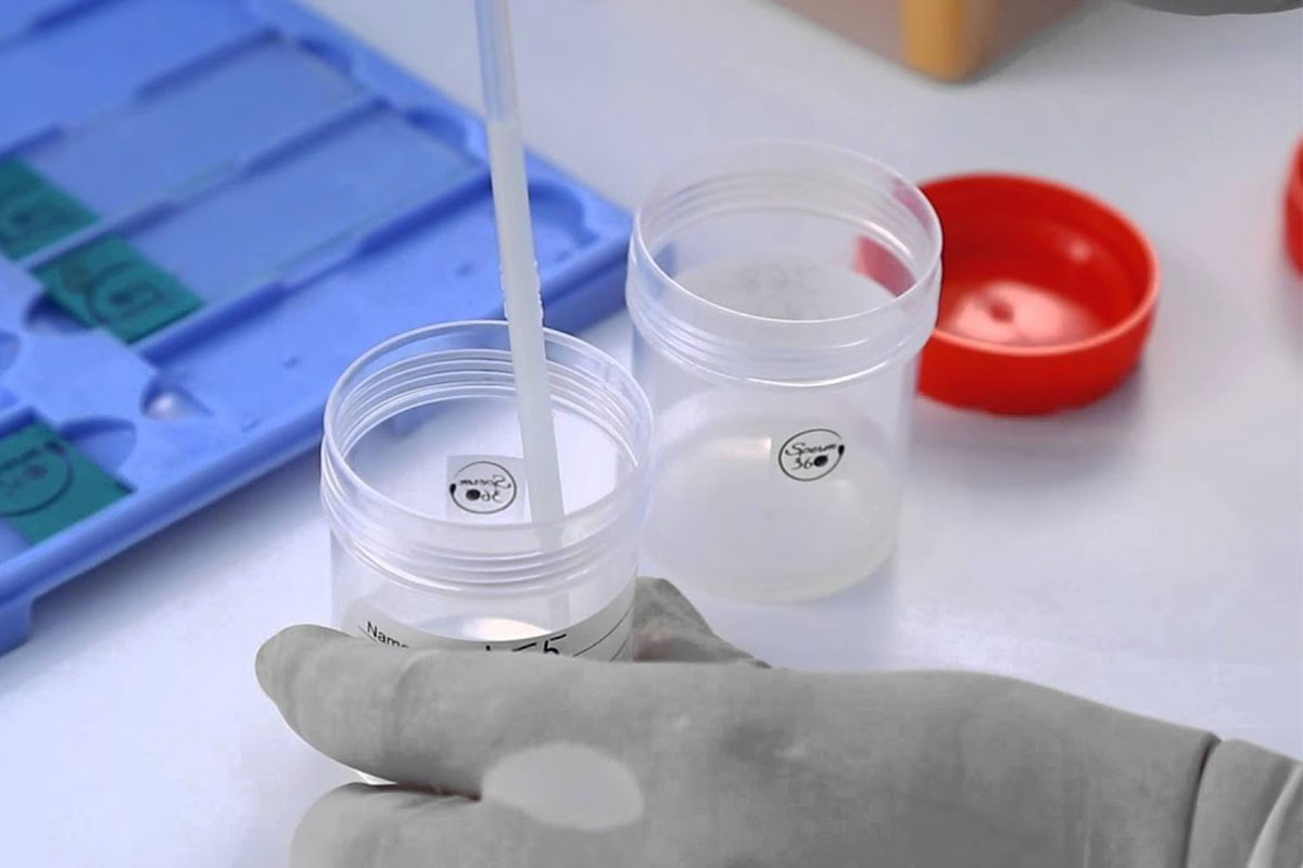 اسرع علاج للزوجه عند الرجال