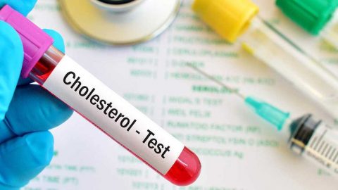 ما هو تحليل LDL cholesterol فحص الكوليسترول الضار