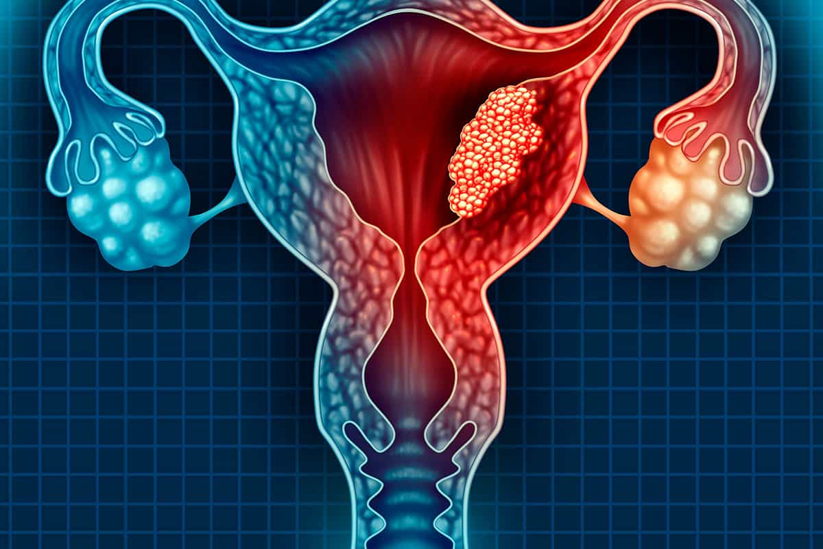 أعراض سرطان الرحم للعذراء
