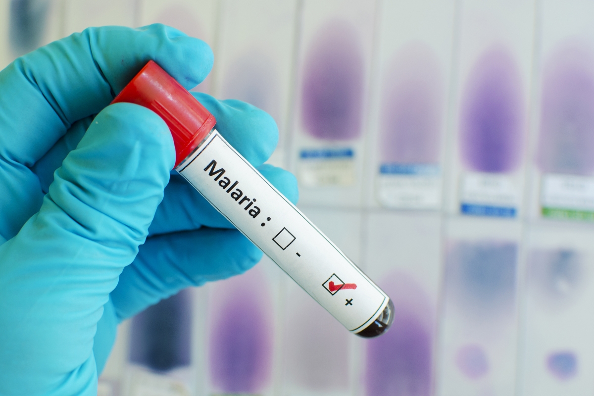 بحث عن مرض الملاريا