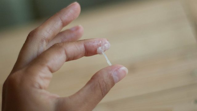 تجربتي مع نزول إفرازات بيضاء متجبنة وقت التبويض