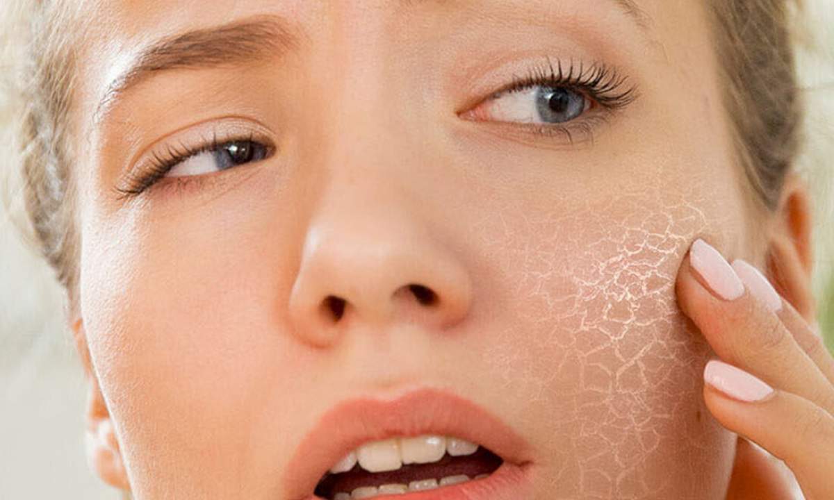 أدوية لعلاج جفاف الجلد