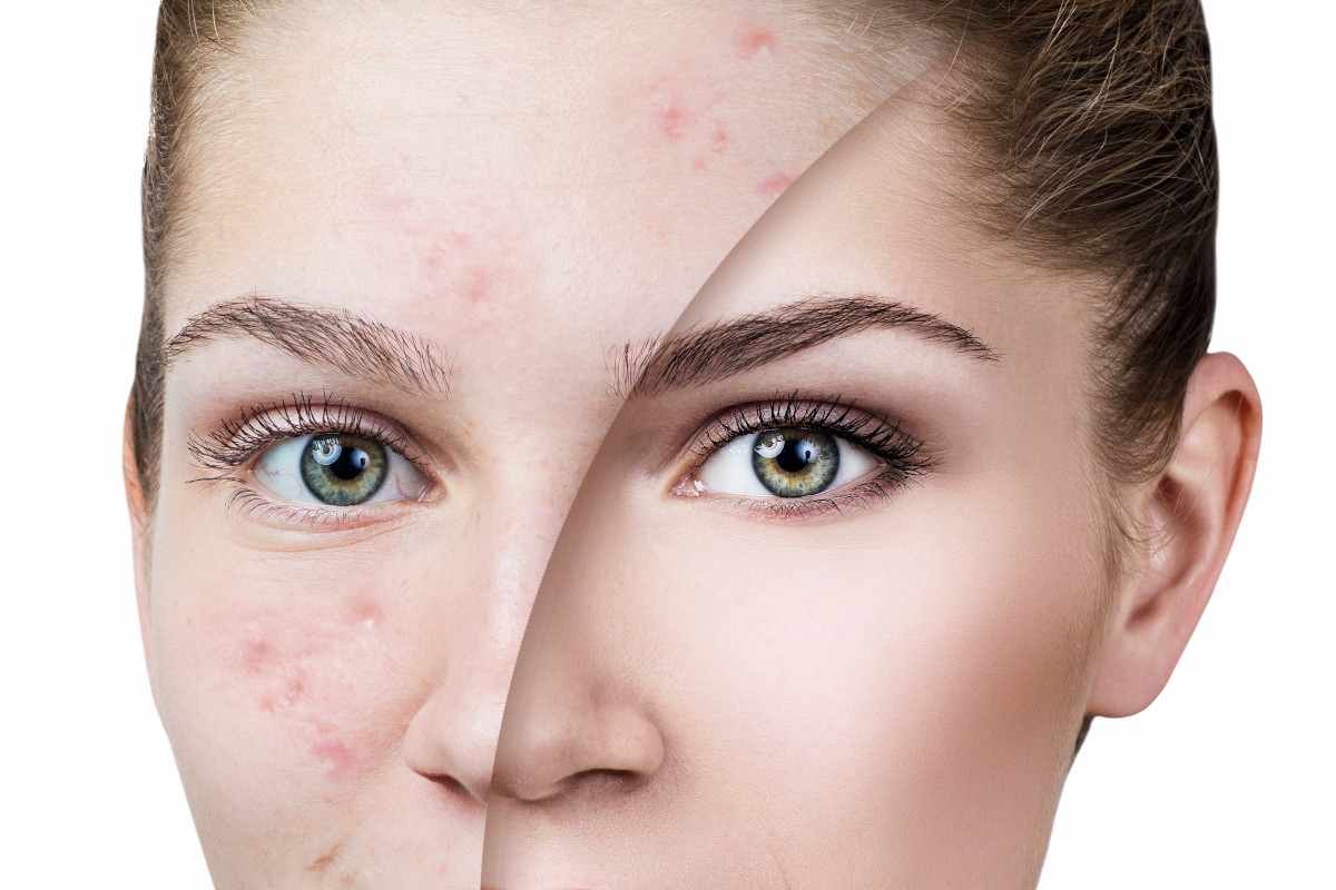 تجربتي مع كريم ميلانو فري