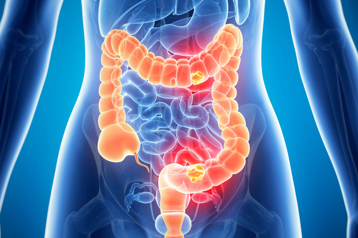 هل القولون العصبي يسبب الخوف من الموت