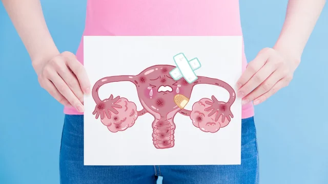 تجربتي مع استئصال الرحم