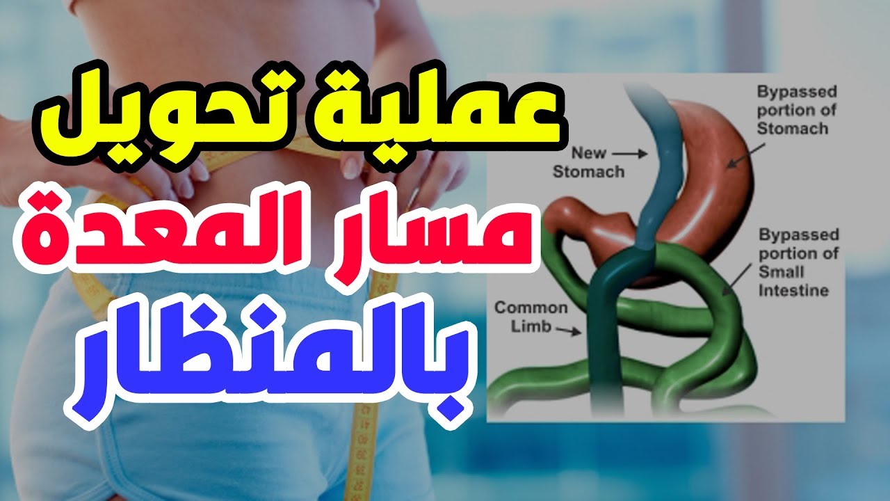 ما هي عملية تحويل المسار