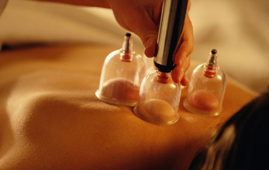 كم سعر الحجامة بالرياض