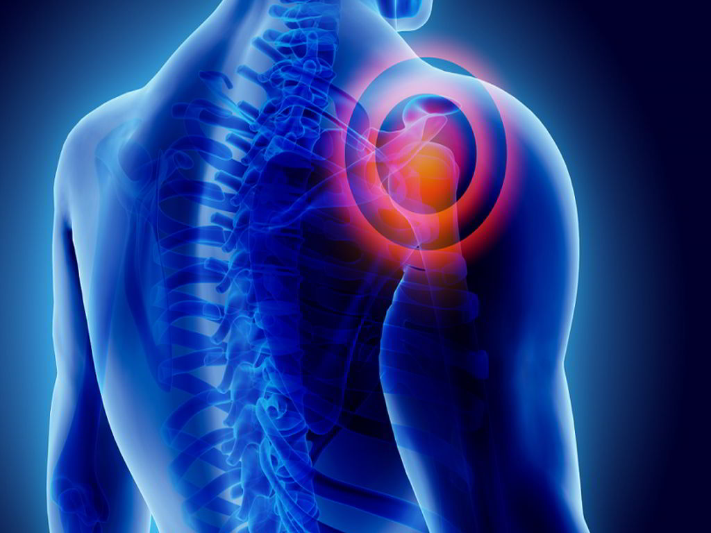 علاج التهاب العصب العضدي