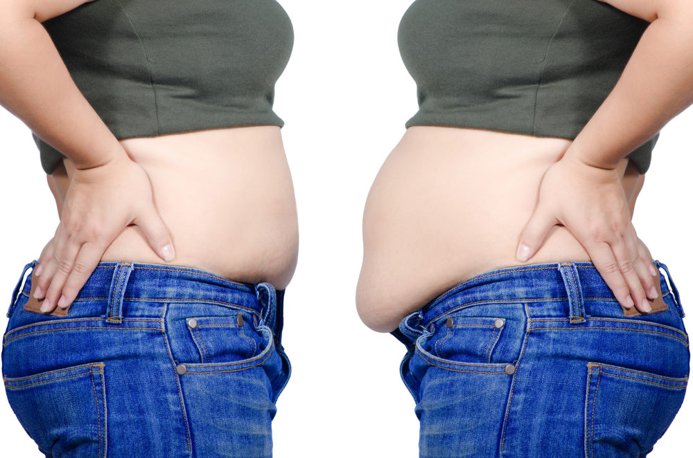 تكلفة عملية شفط دهون البطن في السعودية