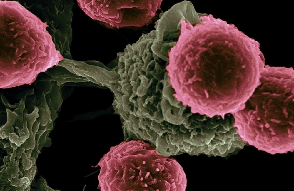 علامات تدل على قرب موت مريض السرطان