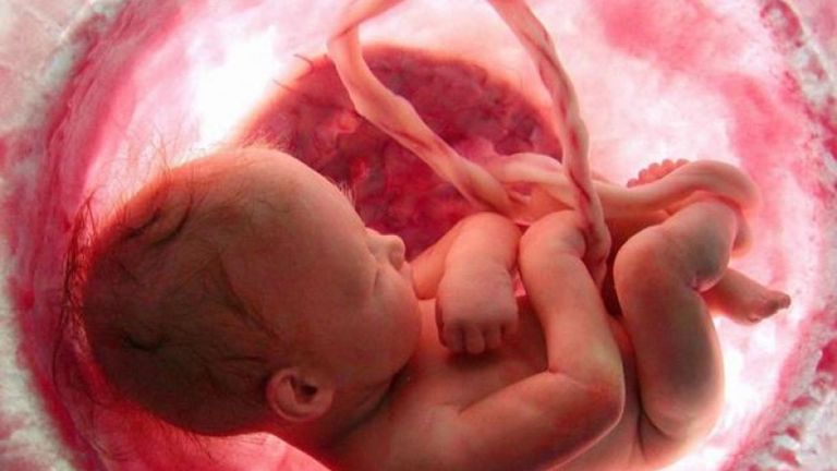 كيف أعرف أعراض تسرب ماء الجنين&nbsp;