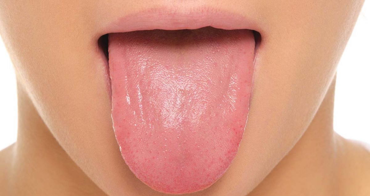 الوان اللسان على ماذا تدل