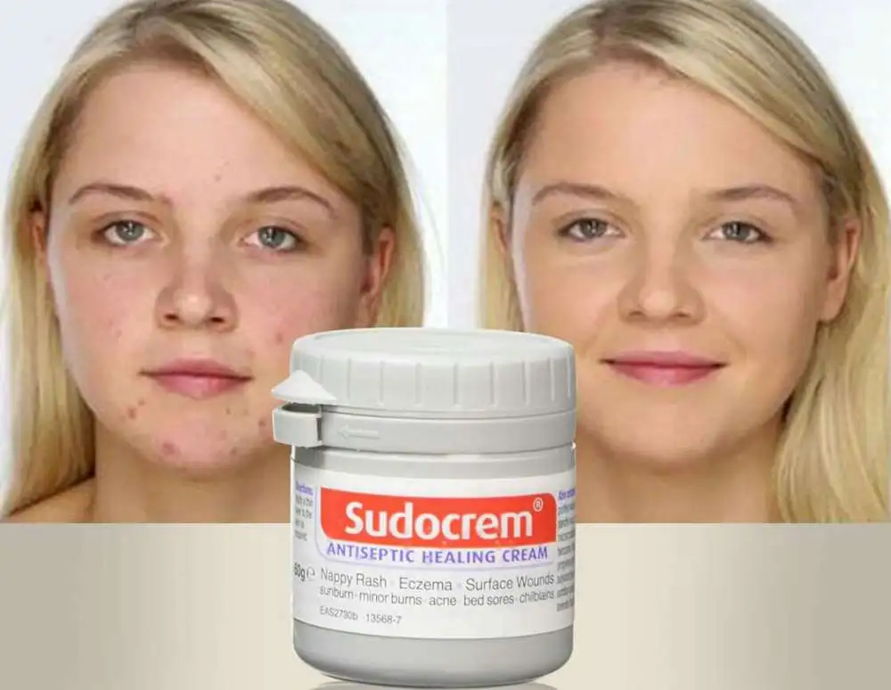 تجربتي مع كريم سودو للمنطقه الحساسة