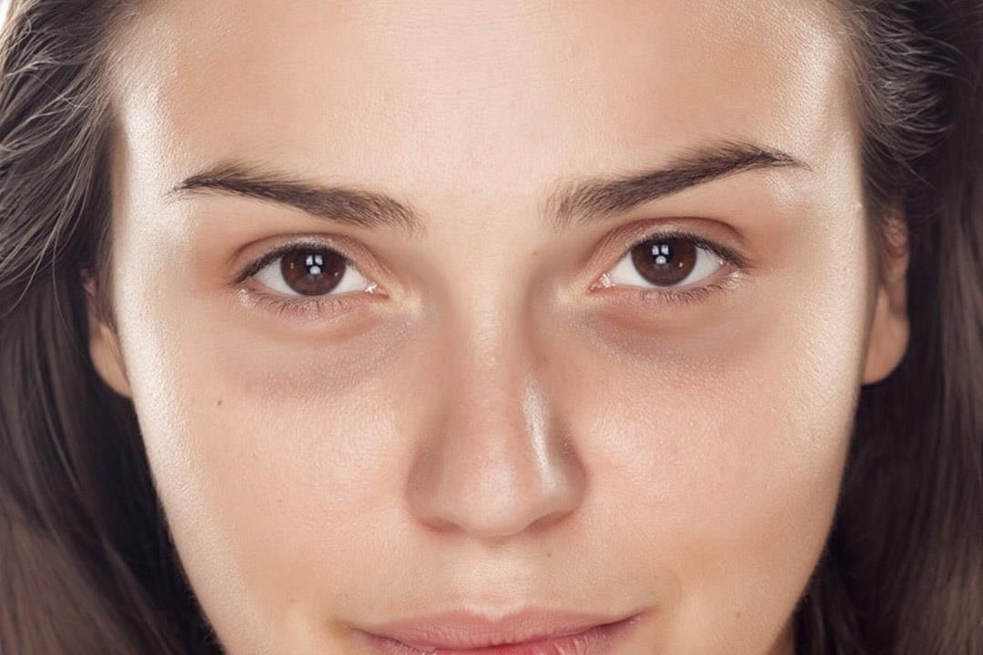 أفضل أنواع سيروم الهالات السوداء 2024