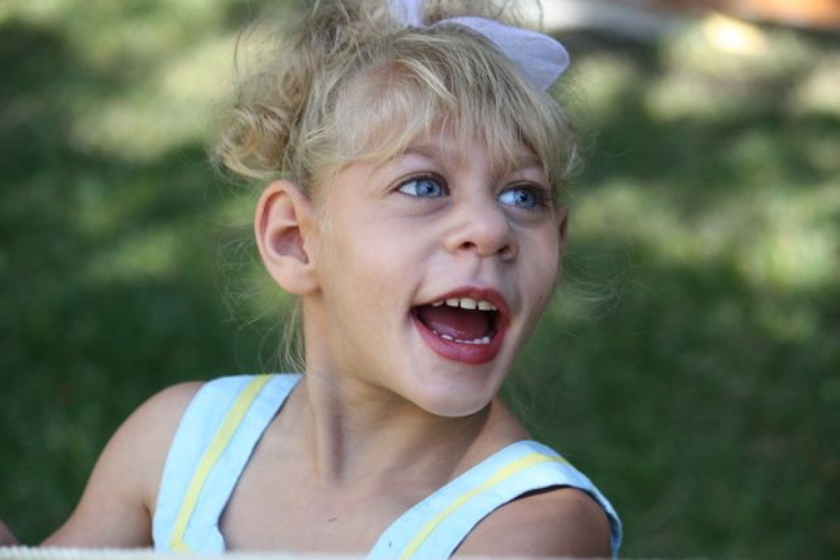 ماهي متلازمة سيكل