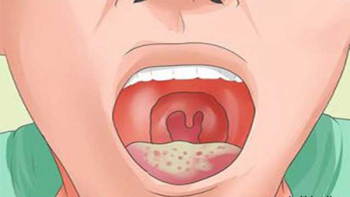 أعراض مرض الايدز عند الأطفال