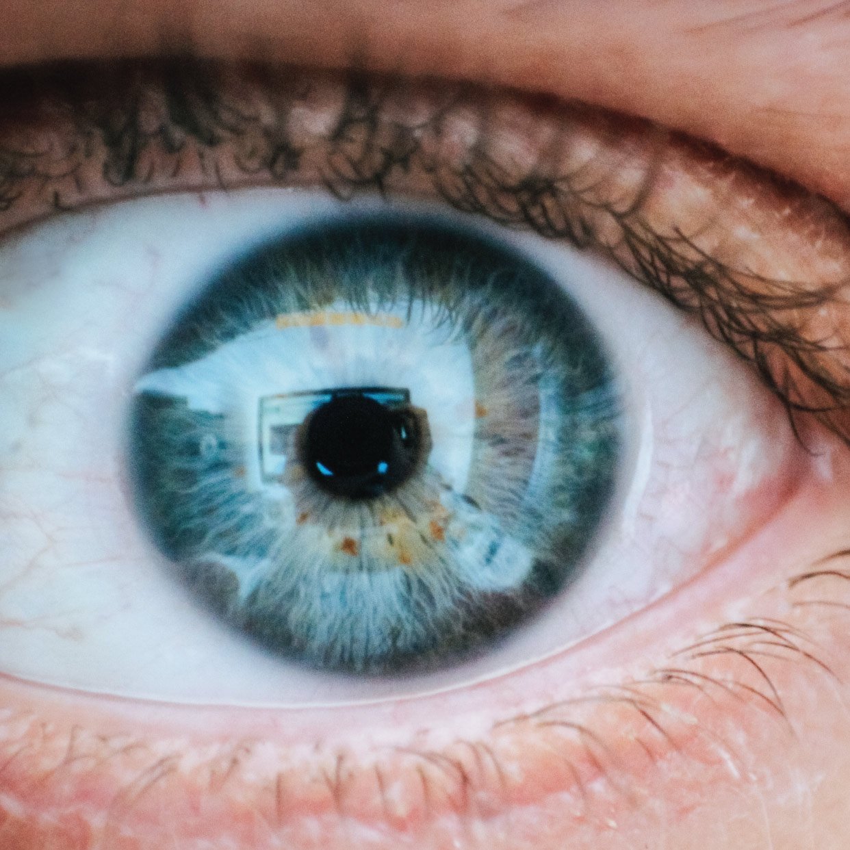 علاج المياه البيضاء والمياه الزرقاء في العين بالأعشاب الطبيعية