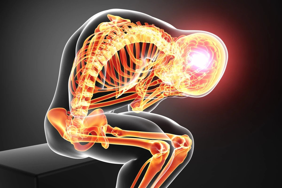 علاج متلازمة كورساكوف