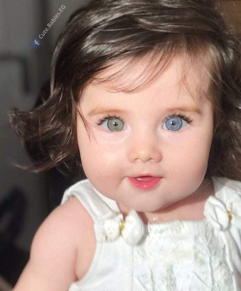 ما هي متلازمة هيتروكروميا