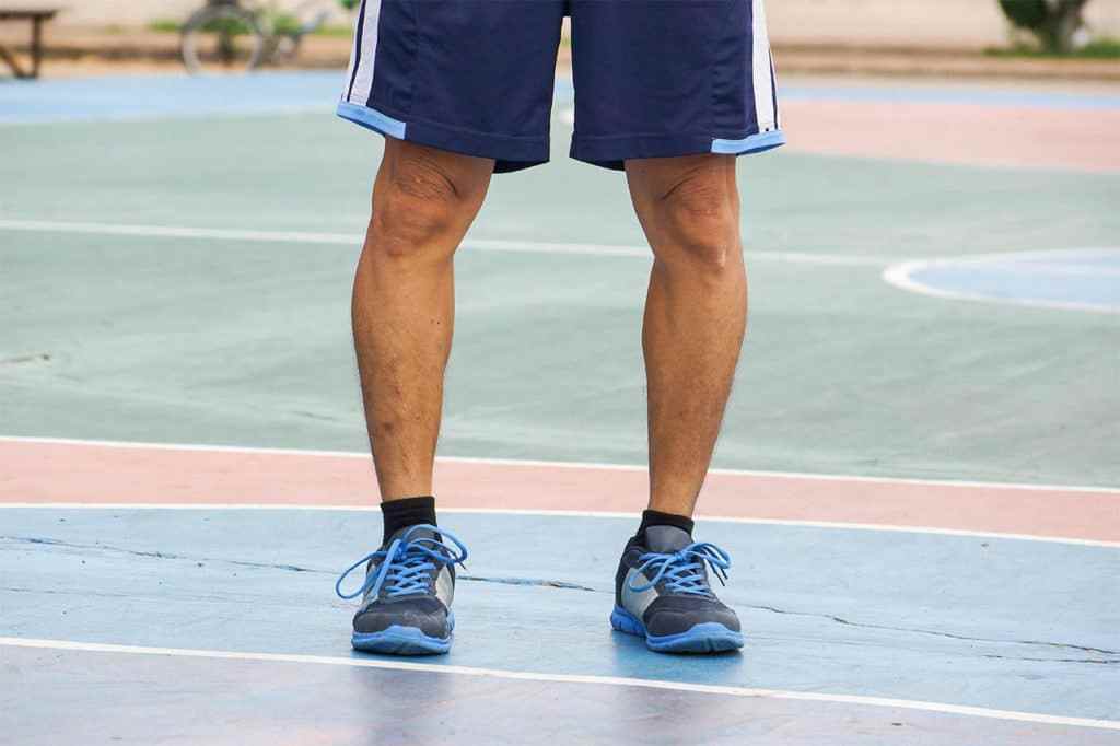 تجربتي مع عملية تقوس الساقين