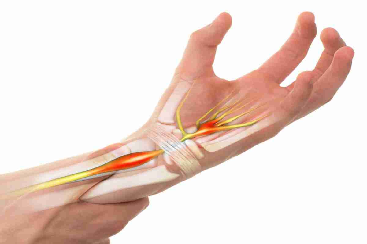 أعراض شد الأعصاب في الجسم