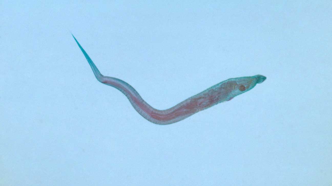 علاج enterobius vermicularis