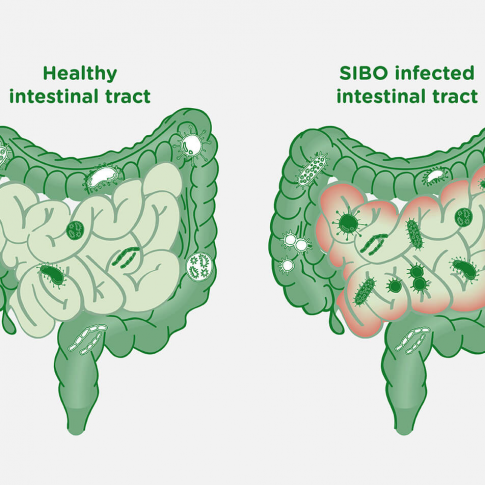 تجربتي مع مرض سيبو والعلامات اللي تبين انني مريض سيبو