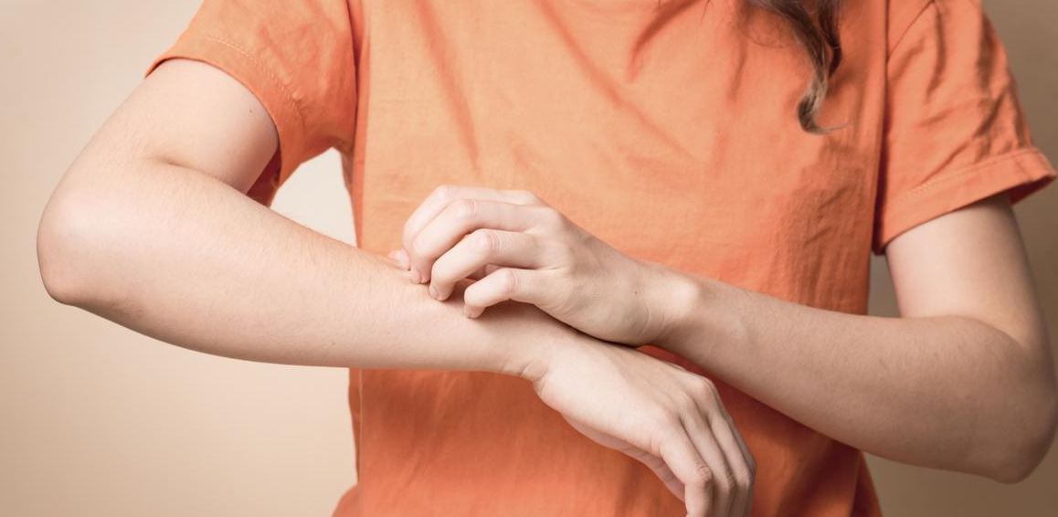 علاج الحكة في الجسم