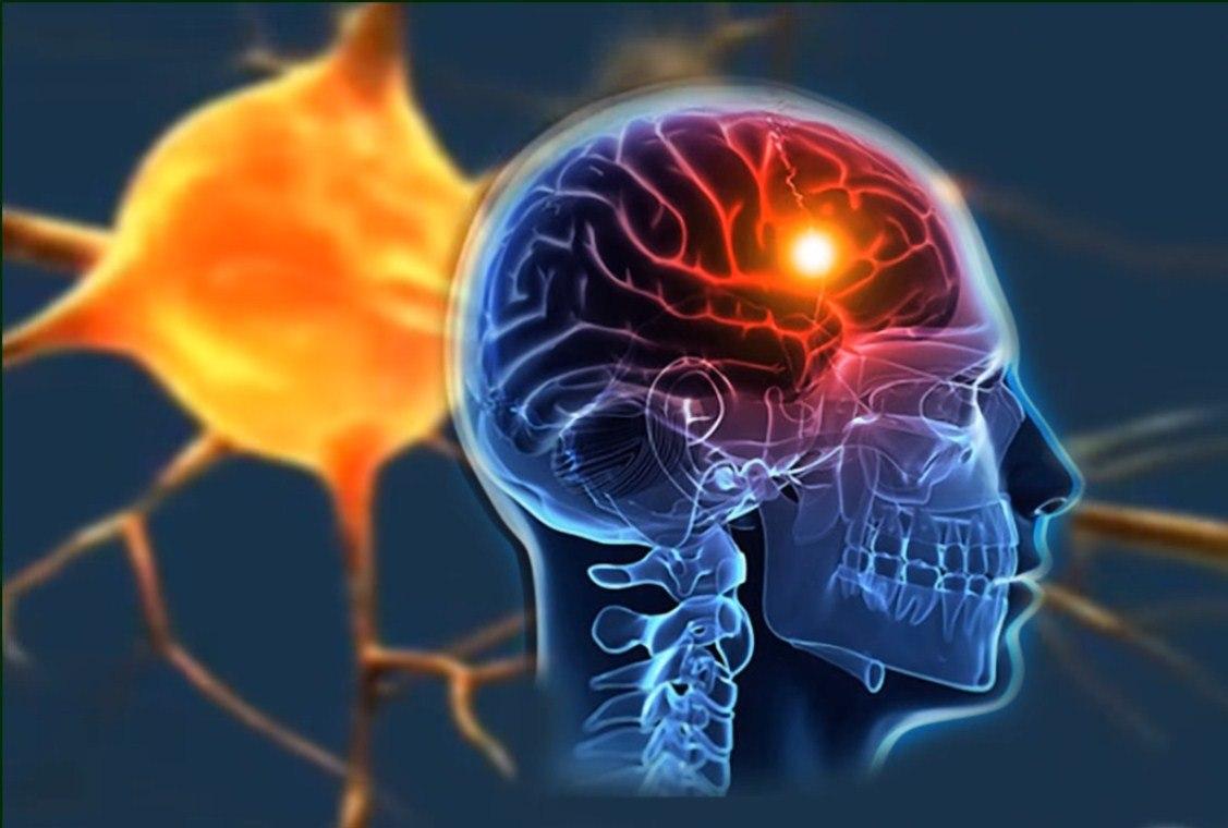 ما هو علاج cerebral edema