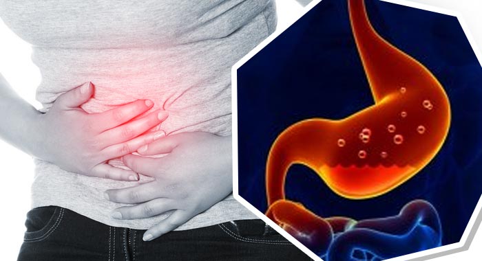 علاج الحموضة عند الحامل 9 طرق سحريه للتخلص من الحموضة