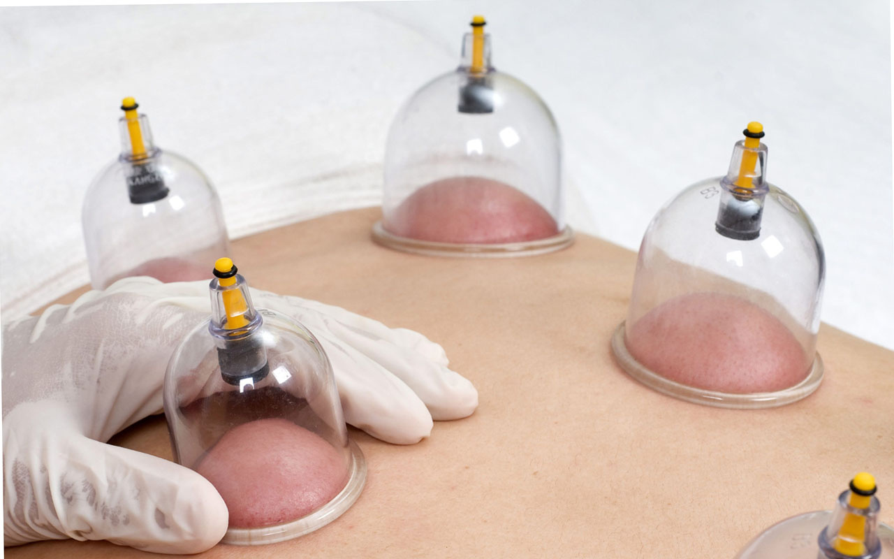 دليلك الشامل لأماكن وضع كاسات الهواء للحمل وفوائدها ومخاطرها&nbsp;